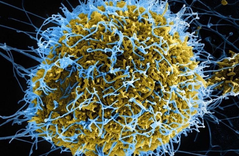 Uh-Oh — Dr. Robert Malone: Latest Disease Spreading Across China an “Ebola-Like Hemorrhagic Fever Virus”
